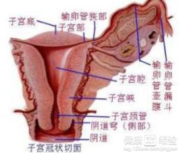 子宫腺肌症的最新疗法-子宫腺肌症创新治疗法