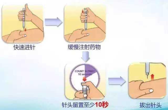 揭秘胰岛素注射最新教程：专业视频教学，轻松掌握注射技巧